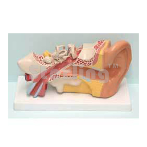 EAR ENLARGED, MEDIUM SIZE